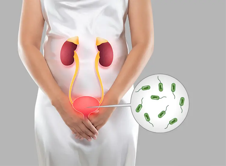 Obat Infeksi Saluran Kemih | Obat ISK